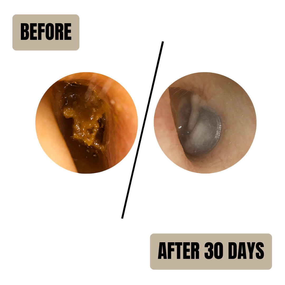 Aurify Nova™ Soft Ear Cleaner